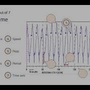 Vibration Waveform Plot Analysis Recognize Parts Cat I Question