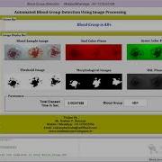 Matlab Code For Blood Group Detection Using Image Processing