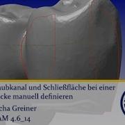 ICAM 4 6 IMES ICORE Schraubkanal Und Schließfläche Manuell Definieren