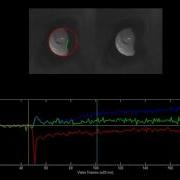 Pupil Segmentation Tracking