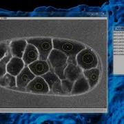 Tutorial LimeSeg 4 Multiple Objects Segmentation
