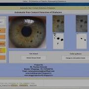 Diabetic Retinopathy Detection Using Image Processing Matlab Project With Source Code