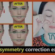 Type 1 How To Fix Asymmetrical Face Get A Symmetrical Face Naturally Facial Asymmetry Exercises