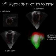 Endocardial 3D Ultrasound Segmentation Using Autocontext Random Forests MICCAI Challenge 2014