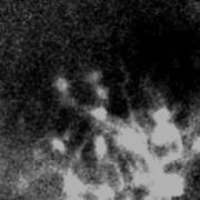 Neurons Firing In Hippocampus