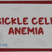 Sickle Cell Anemia Causes Symptoms Diagnosis Treatment Pathology