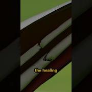 How Do Broken Bones Heal