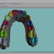 BlueSkyPlan V4 7 15 Step3 Tooth Segmentation