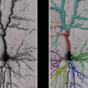 Automated Tree Reconstruction In A Brightfield Micrograph