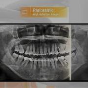 Rayscan Alpha Plus CBCT