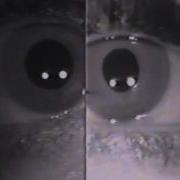 Dilation Lag ARCHIVE