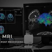 MRI DTI W Post Processing