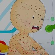 Chicken Pox Caillou WildBrain Kids