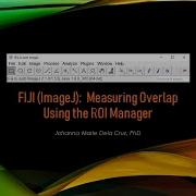 FIJI ImageJ Measuring Overlap Using The ROI Manager