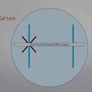 Diphtheria And Elek S Gel Precipitation Test