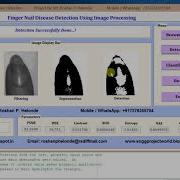 Finger Nail Disease Detection Using Image Processing Matlab Project With Source Code