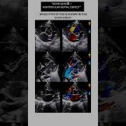 Echo Quiz Ventricular Septal Defect Echocardiography Cardiologyeducation 2decho