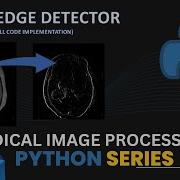 Sobel Edge Detector Python Code Implementation Image Processing Computer Vision