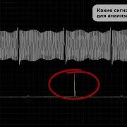 CSS тест USB Autoscope IV Лекция Андрея Шульгина часть 1