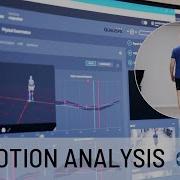 3D Motion Analysis At Gijos Klinikos