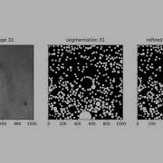 U Net Droplet Segmentation