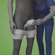Fitting Video Comfort Standing V03 I TENA Professional