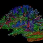 Networks In The Brain Mapping The Connectome