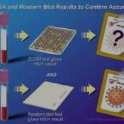 Diagnosis And Testing Of HIV Infection
