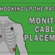 Monitor Cable Placement Hooking Up The Patient Movie Prop Tutorial