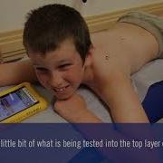 What Happens During Allergy Skin Testing Nemours Children S Health System
