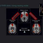 Introduction To FMRI Data Analysis In Python Basic