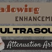 Ultrasound Physics Review Attenuation Artifacts Sonography Minutes