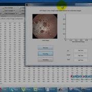 DWT Based Endoscopic Image Compression MATLAB