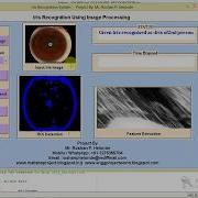 Matlab Code For Iris Recognition Using Image Processing Full Source Code IEEE Based Project