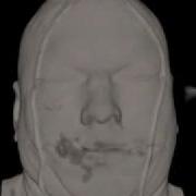 Human Head Volume Rendering