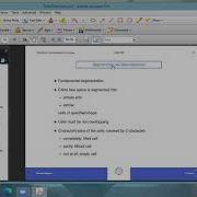 Robot Motion Planning Part 2