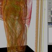 VoTracer 1D 2D Transfer Functions For Volume Rendering