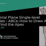 Tibia Frontal Plane Single Level Deformities ABCs Michael Assayag MD