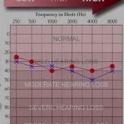 How To Read An Audiogram