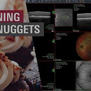 Multi Modality Viewer HEYEX 2