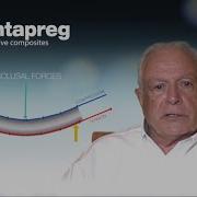 Dentapreg Tips By Dr Pitz 03 Composite Bridges