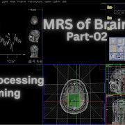 MRS Of Brain Technique Part 02 Post Processing Filming MR Spectroscopy SIEMENS MRI