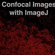 Analyzing Confocal Images With ImageJ