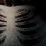 Team Free Will Bones Imagine Dragons