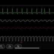Simulated Patient Monitor