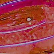 The Samali Lid Earrape