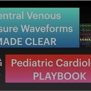 7 Minutes Central Venous Pressure Waveforms MADE CLEAR By Pediatric Cardiology PLAYBOOK