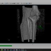 BonesViewer Split Volume Using Neighbour Algorithm VTK Qt