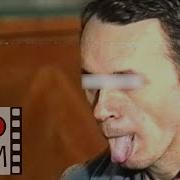 R Шизофрения Кататонический синдром Catatonic Syndrome Psychiatry