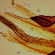 Fascinating Honeybee Anatomy Under The Microscope